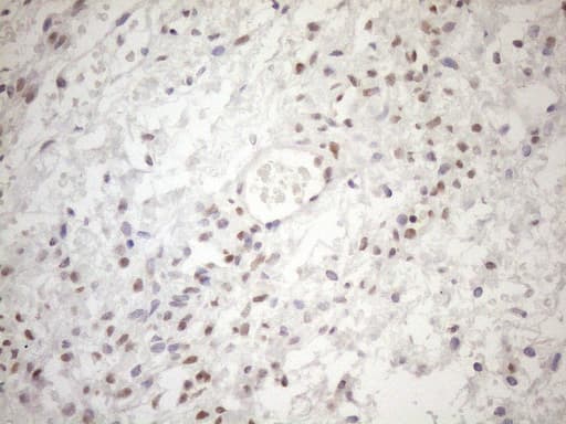 Monoclonal Mouse anti-Human MGMT Antibody (clone OTI2F10, IHC, WB)