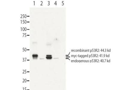 Polyclonal Rabbit anti-Human RRM2B / P53R2 Antibody (N-Terminus, IHC, WB)