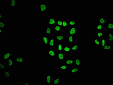 HIST1H2AI Antibody