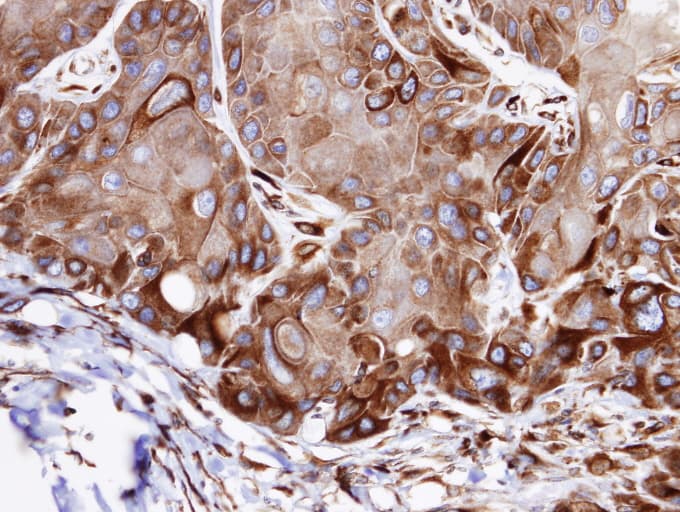 Polyclonal Rabbit anti-Human VPS16 Antibody (aa715-804, IHC, WB)