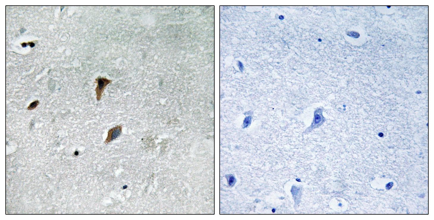 MAP2K3 / MEK3 / MKK3 Antibody (phospho-Thr222)