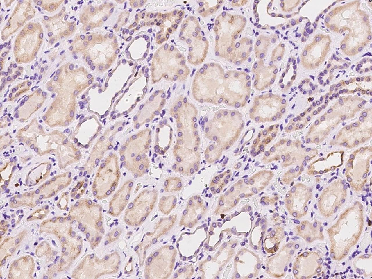 ZCCHC9 Antibody