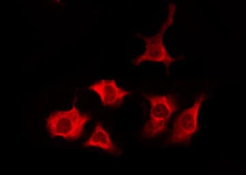 TAS2R1 Antibody