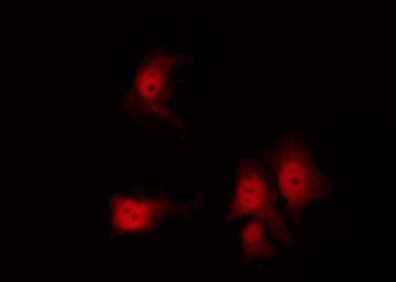 KRT8 / CK8 / Cytokeratin 8 Antibody (phospho-Ser432)
