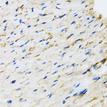 Polyclonal Rabbit anti-Human RAF1 / RAF Antibody (IHC, IF, WB)