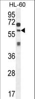 Polyclonal Rabbit anti-Human ZSWIM1 Antibody (aa443-471, IHC, WB)
