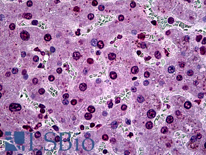 IHC-plus™ Monoclonal Mouse anti-Human SGK1 / SGK Antibody (clone 1C4, IHC, IF, WB)