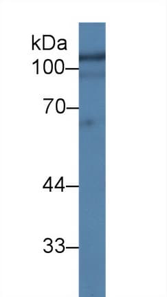 HEXB Antibody (aa122-311)