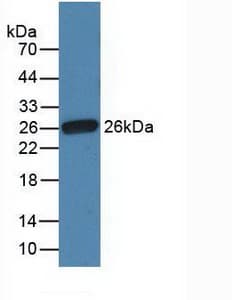 FN1 / Fibronectin Antibody (aa510-689, PE)