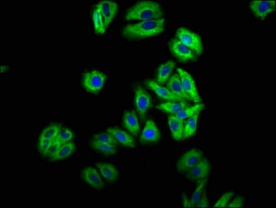 MIP / AQP0 / Aquaporin 0 Antibody