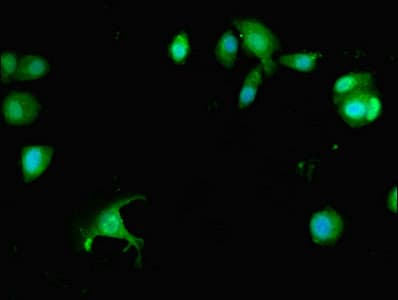 Polyclonal Rabbit anti-Human PREX1 / P-REX1 Antibody (IHC, IF)