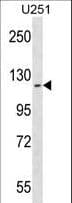 ATP13A2 Antibody (aa1133-1161)