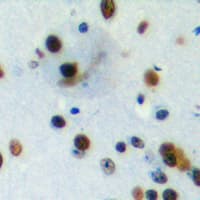 PIAS4 / PIASY Antibody (C-Terminus)