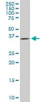 Monoclonal Mouse anti-Human DCPS Antibody (clone 3E5, WB)