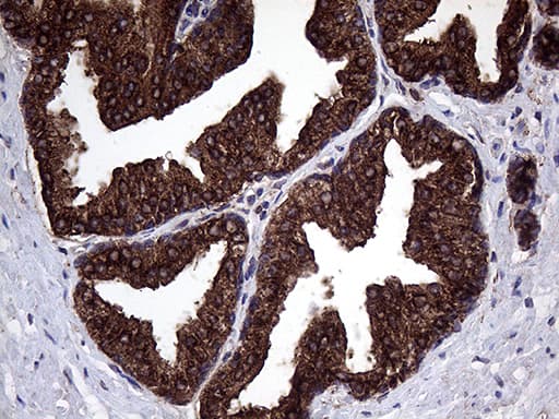 Monoclonal Mouse anti-Human CLTA / LCA Antibody (clone OTI2D12, IHC, WB)