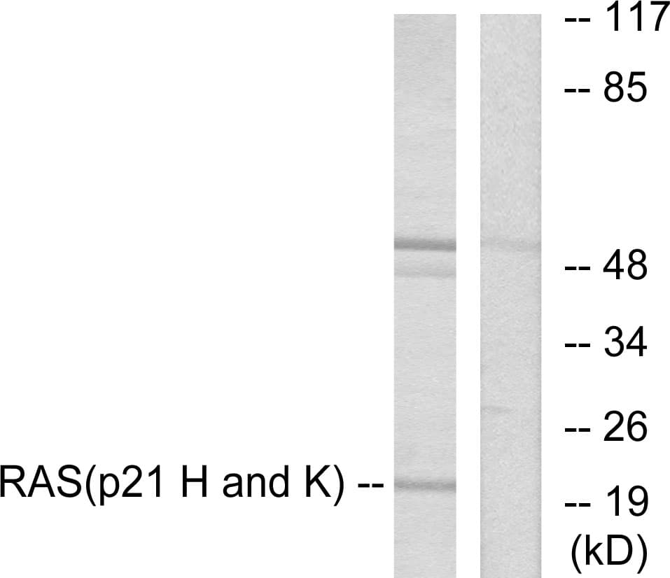IHC-plus™ Polyclonal Rabbit anti-Human Pan Ras Antibody (aa1-50, IHC, WB)