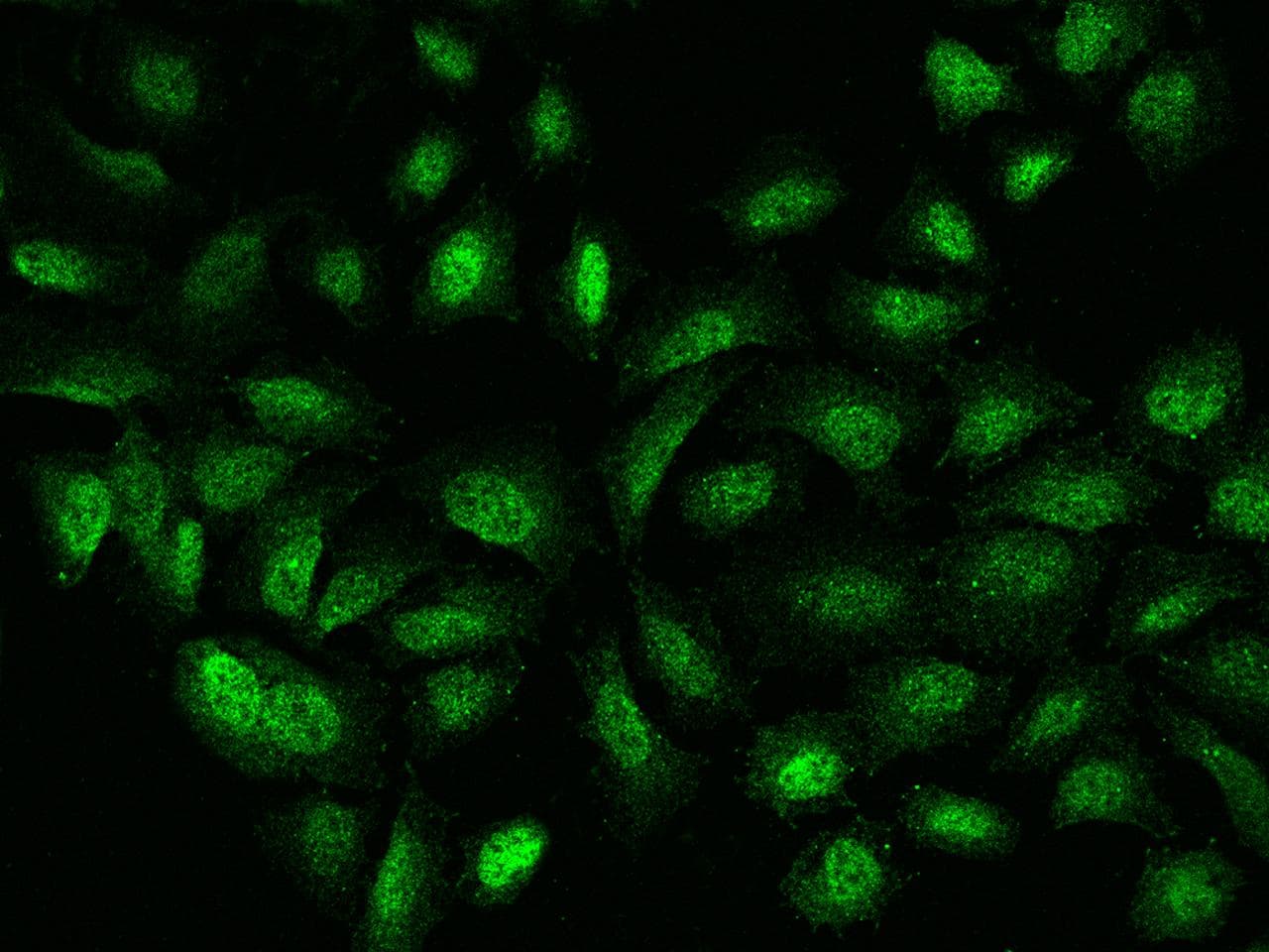 Polyclonal Rabbit anti-Human GATAD2B Antibody (IF)