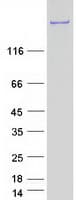 Human Dysferlin Protein (Recombinant Myc-DDK (Flag))