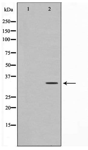 C1orf35 / MMTAG2 Antibody