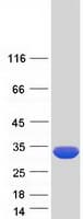 Human KCTD1 Protein (Recombinant Myc-DDK (Flag))