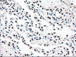Monoclonal Mouse anti-Human STK3 Antibody (clone OTI2D4, IHC, WB)