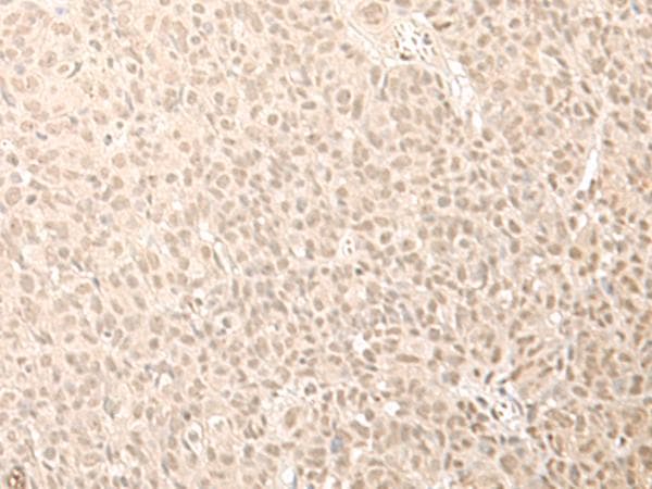 CNOT10 Antibody