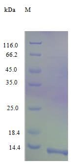 Human CCL17 / TARC Protein (Recombinant)