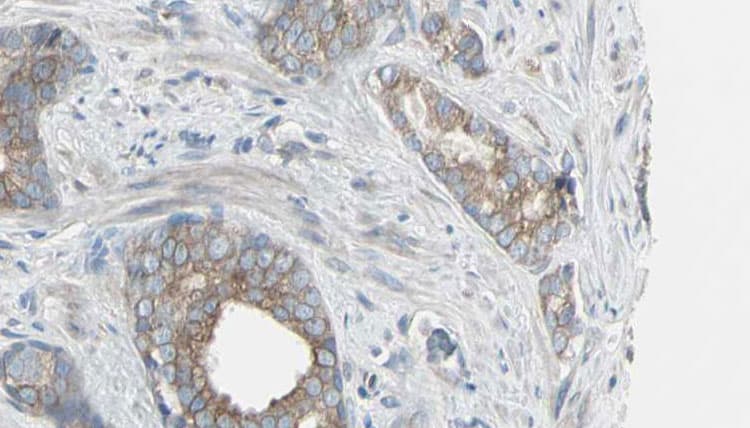 GSS / Glutathione Synthetase Antibody