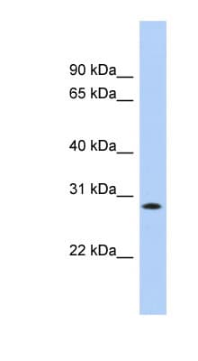 KCTD17 Antibody (aa179-228)