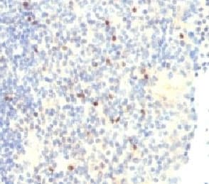 FOXP3 Antibody (N-Terminus, clone FHBP3-1)