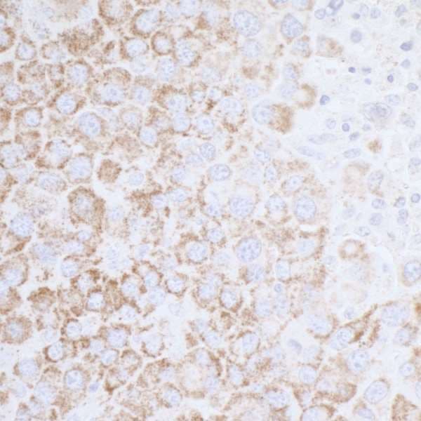 ATP5A1 / ATP Synthase Alpha Antibody (aa100-150)