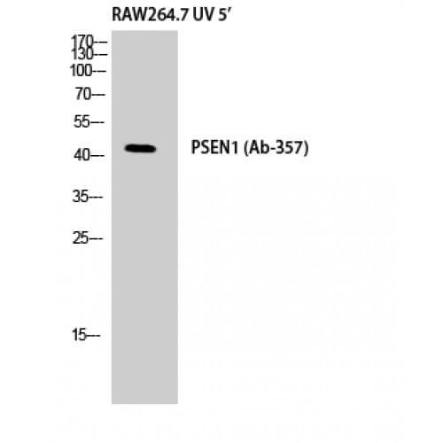 PSEN1 / Presenilin 1 Antibody (300-380 aa)