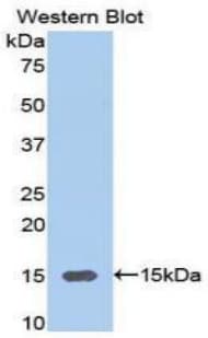 GPT / Alanine Transaminase Antibody (aa367-480)