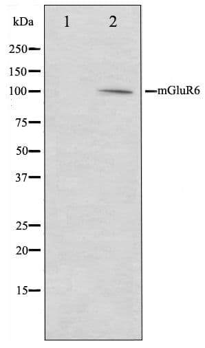 GRM6 / MGLUR6 Antibody