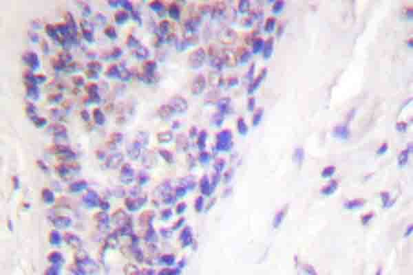NFKB1 / NF-Kappa-B Antibody (phospho-Ser927)