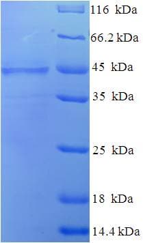 Human COLEC10 Protein (Recombinant His-SUMO)