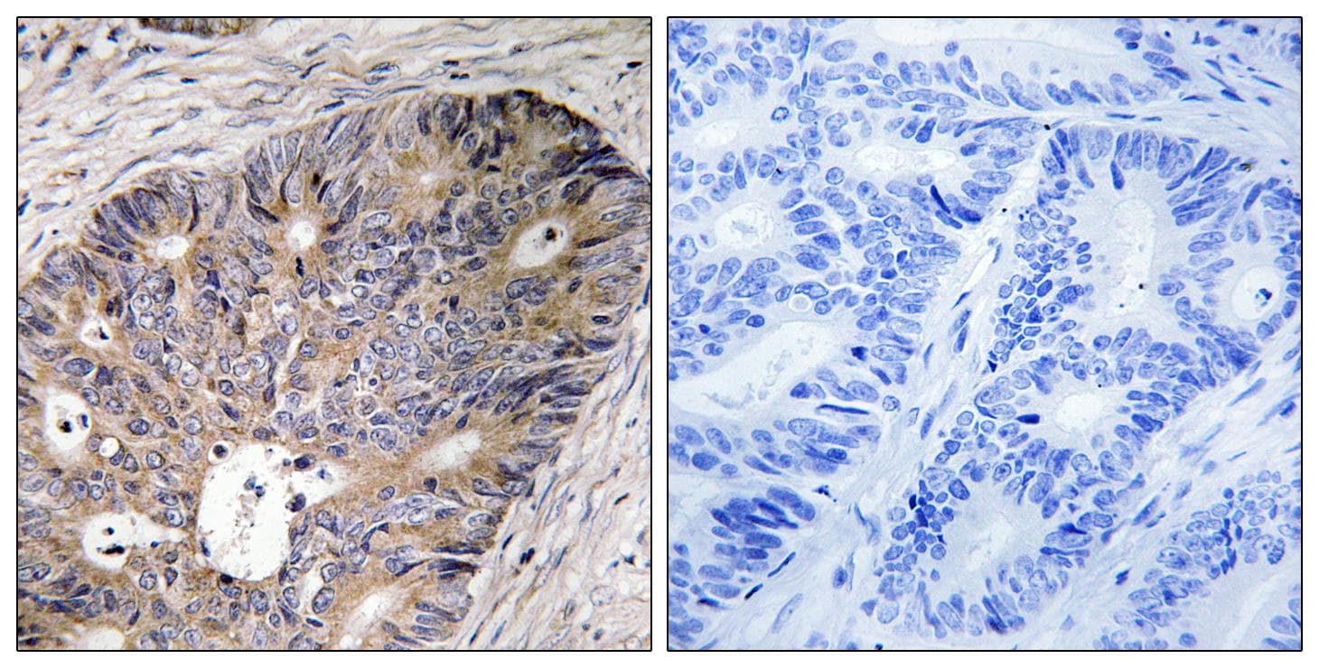 Polyclonal Rabbit anti-Human CAD Antibody (Ab-456, IHC)