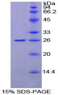 Rat GSTK1 Protein (Recombinant His-T7)