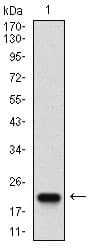 CASP7 / Caspase 7 Antibody (clone 4D10B2)