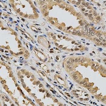 LGALS3 / Galectin 3 Antibody