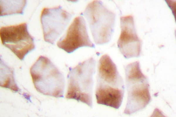 Polyclonal Rabbit anti-Human Actin, Alpha+Gamma Antibody (Gln49, IHC, IF, WB)