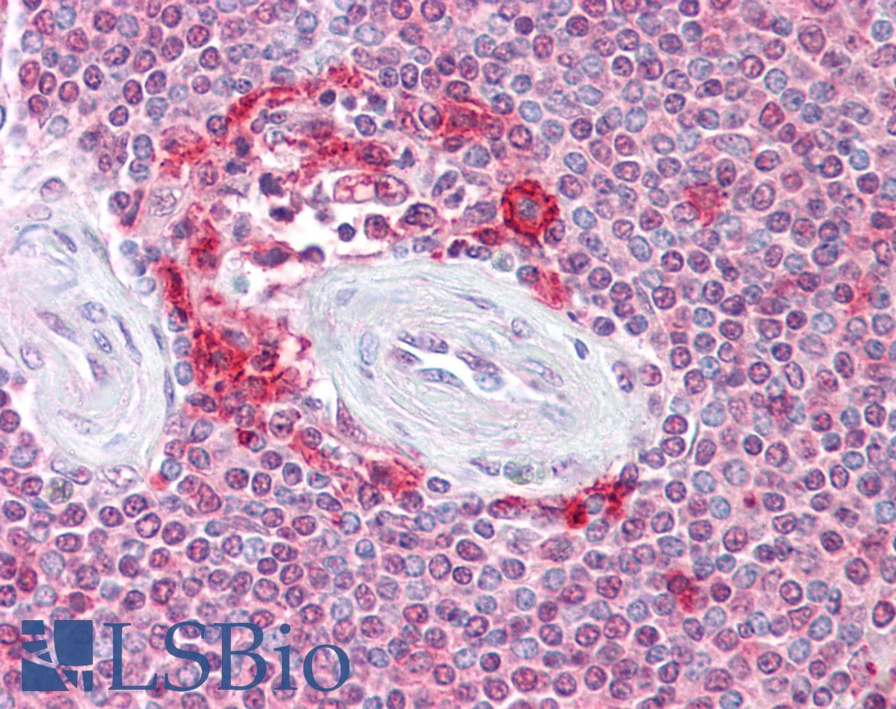 IHC-plus™ Polyclonal Rabbit anti-Human ATG9A Antibody (IHC, IF, WB)