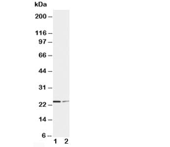 Polyclonal Rabbit anti-Human SOCS1 Antibody (aa197-211, IHC, WB)