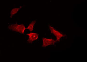 Polyclonal Rabbit anti-Human TNK2 / ACK1 Antibody (phospho-Tyr857,phospho-Tyr858, IF, WB)