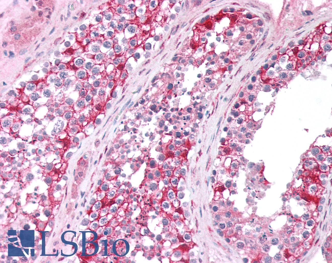 IHC-plus™ GAMT Antibody