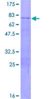 Human COL8A2 / Collagen VIII Protein (Recombinant GST)