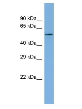 Polyclonal Rabbit anti-Human HS6ST2 Antibody (aa547-596, WB)