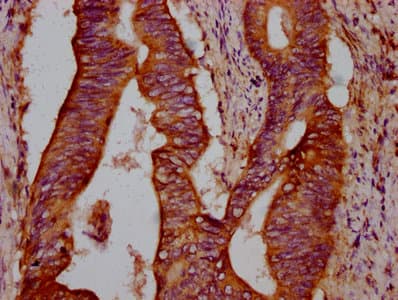 TIRC7 / TCIRG1 Antibody