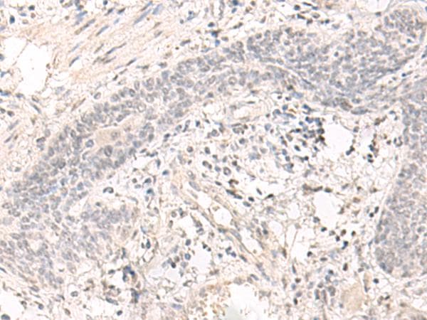 Polyclonal Rabbit anti-Human SAP130 Antibody (IHC)
