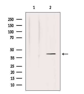 NRG1 / Heregulin / Neuregulin Antibody